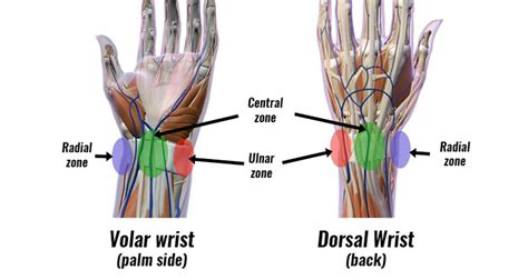 Wrist Pain By Location - Sportsinjuryclinic.net