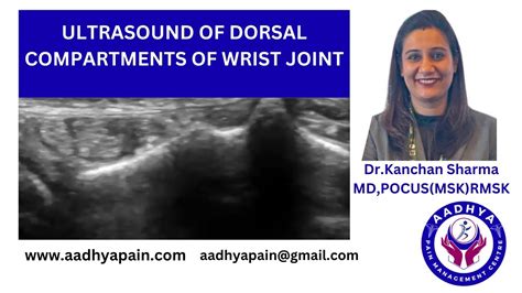 Ultrasound of the dorsal compartments of the wrist joint - YouTube