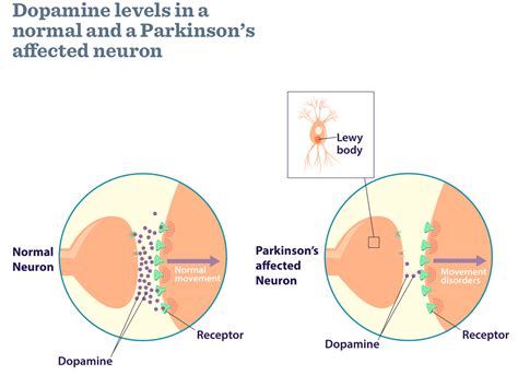 Dopamine - Function, Dopamine Deficiency, How to Increase Dopamine