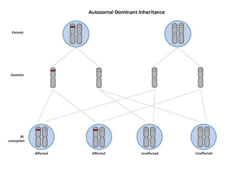 Achondroplasia: Definition And Genetic Conditions