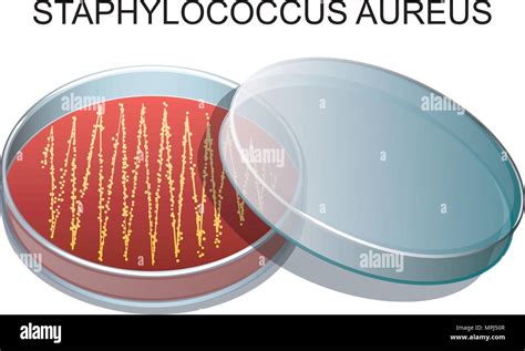 Staphylococcus Aureus Petri Dish