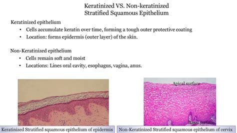 Nonkeratinized Stratified Squamous Epithelium Mouth