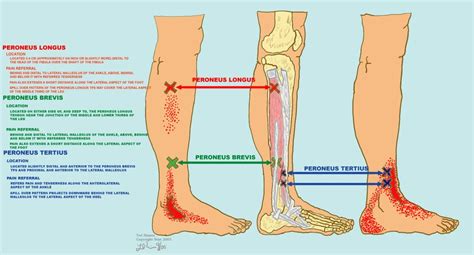 Muscle Tests Illustrations | Muscle testing, Leg muscle pain, Muscle health