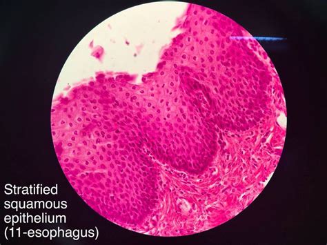 Stratified squamous epithelium (non-keratinized) | Stratified squamous ...