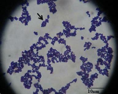 Gram’s staining of S. aureus (100X). Grapes like (black arrow) Gram ...