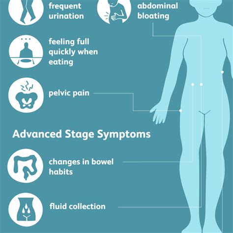 Ovarian Cancer: Signs, Symptoms, and Complications