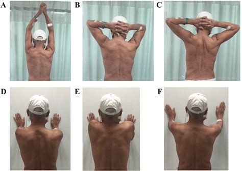 Scapula control exercise. (A-C) Anti-scapular winging exercise ...