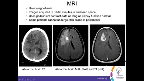 Brain Tumor Color Mri