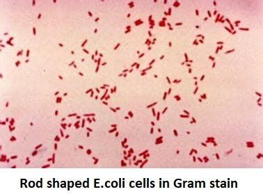 How do you describe the cell morphology of Escherichia coli?