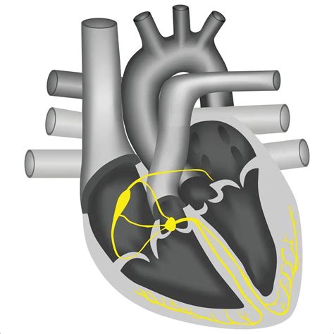 Ventricular Fibrillation: Causes, Symptoms and More - Stayhale