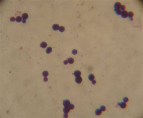 round yeast gram positive cryptococcus neoformans | Gram stain showing ...