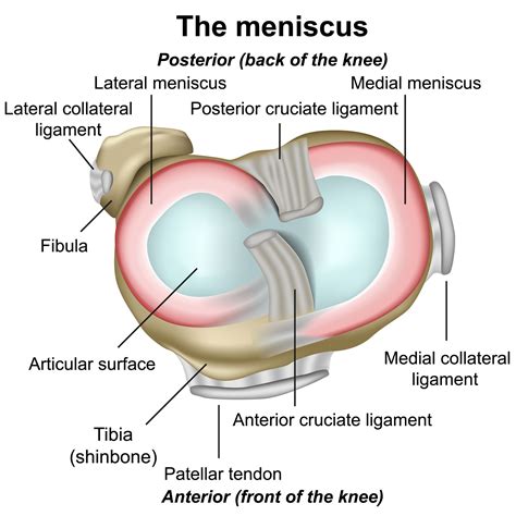 Diagram Of Knee Meniscus Tear