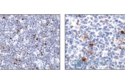 Cleaved Caspase-3 (Asp175) Antibody | Cell Signaling Technology