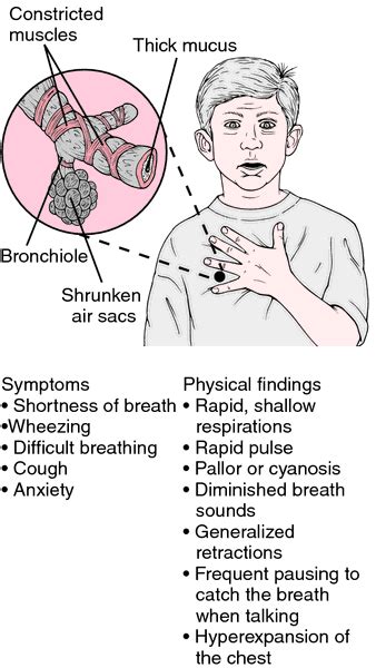 Bronchial Asthma معنى – لاينز