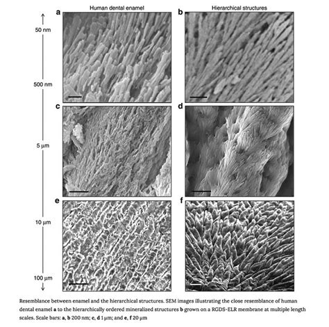 This Research Holds Great Promise for Dental Enamel Regeneration | DOCS ...