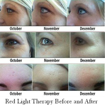 Red & Yellow Light Therapy Seriously Fights Aging | Red light therapy ...