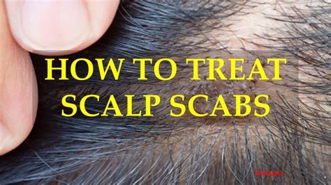 Bumps On The Scalp: What Are Causes And Treatments? CBA