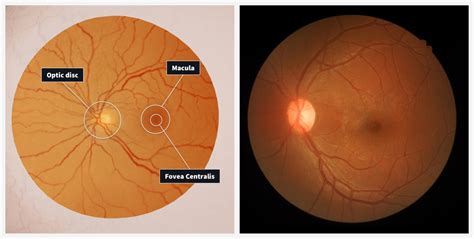 Eye Model Labeled Fovea Centralis