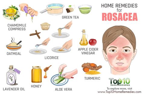 What Is the Best Treatment for Rosacea on the Face