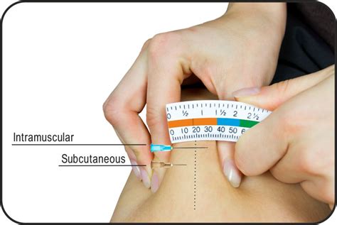 Expanded needle and syringe guide | Union Medico