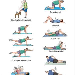 Exercises For Sciatica: Mckenzie Back Exercises For Sciatica