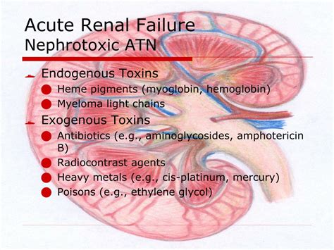 PPT - Acute Renal Failure PowerPoint Presentation, free download - ID ...