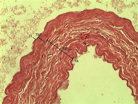 Large Vein 20X | Histology