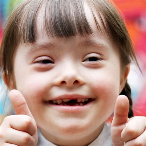 11 Facts About Down Syndrome | DoSomething.org