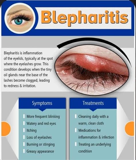 Cataract progression, Blepharitis and Development of Glaucoma..