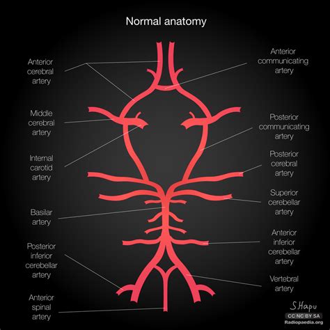 Brain Inferior View Circle Of Willis