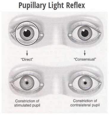 Corneal Light Reflex