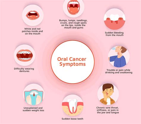 SYMPTOMS AND CAUSES OF ORAL CANCER