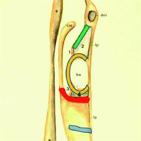 The lateral lamella (*) has a variable degree of angulation towards the ...