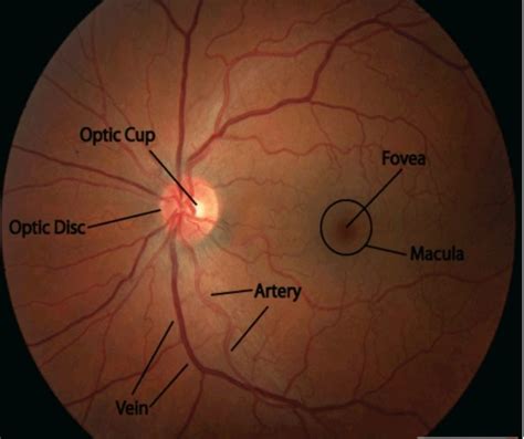 Procedure of Fundus Examination - Optography