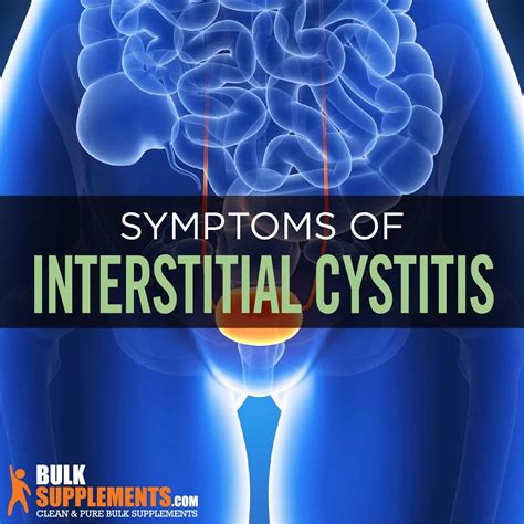 Interstitial Cystitis: Symptoms, Causes & Treatment