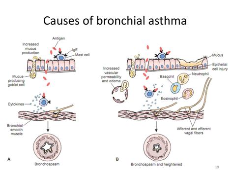 PPT - Pathophysiology of the respiratory system PowerPoint Presentation ...