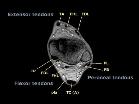 52 best images about MRI anatomy on Pinterest