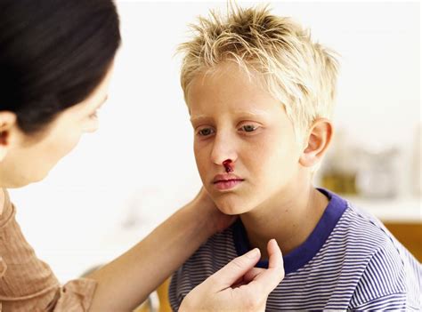 Nosebleeds in children: When to see a doctor, causes, and prevention