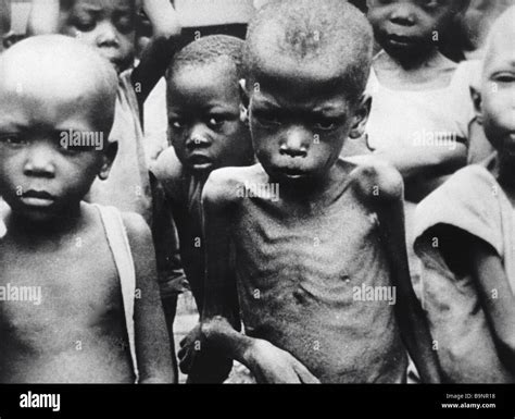 The starving children of Ethiopia Stock Photo - Alamy