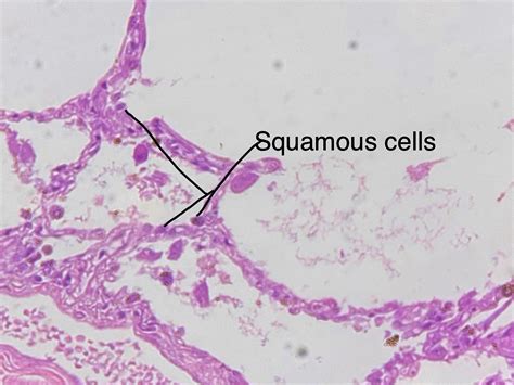 Simple Squamous Epithelium Histology Labeled