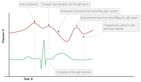 Interpretation of the central venous pressure waveform | Deranged ...