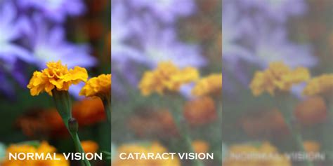 image processing - Simulate cataract vision in OpenCV - Stack Overflow