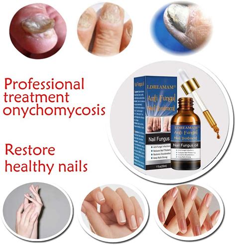 Buy Fungal Nail Treatment,Toenail Fungus Treatment,Antifungal Treatment ...