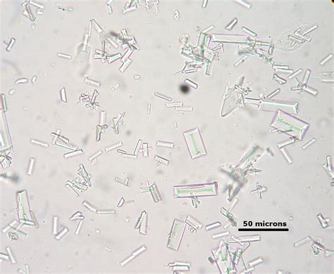 What are the types of Crystals found in Urine?