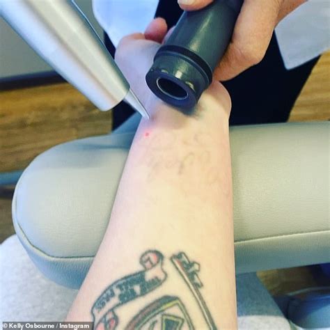 Kelly Osbourne Shares A Glimpse At Her Laser Tattoo Removal For THREE ...