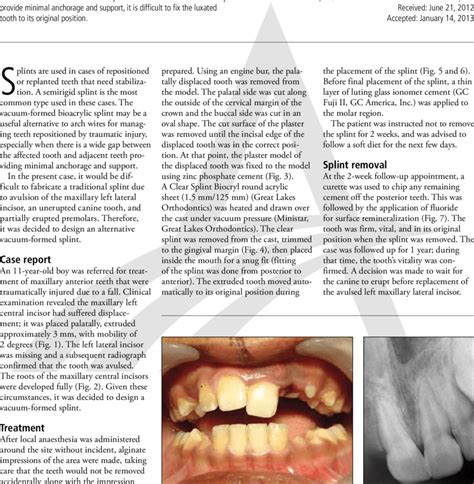 An 11-year-old patient with luxated tooth No. 9. Fig. 2. A radiograph ...