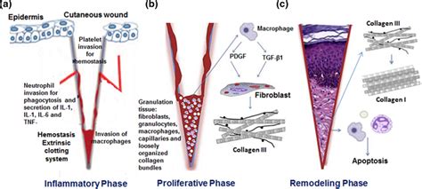 Phases of Wound healing; a Inflammation Phase- blood vessel growth, b ...