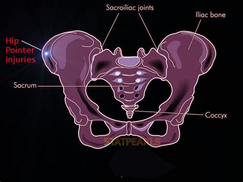 Types Of Hip Pointer