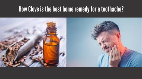 How Clove is the best home remedy for a toothache? - Medical Darpan