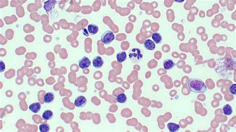 Mastering Haematology: Practical approach to CBC/Blood Smear